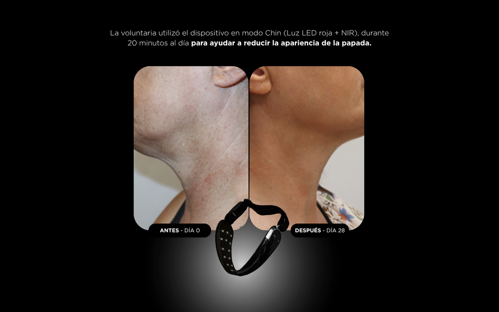 UNICLED NECK & CHIN 5.0