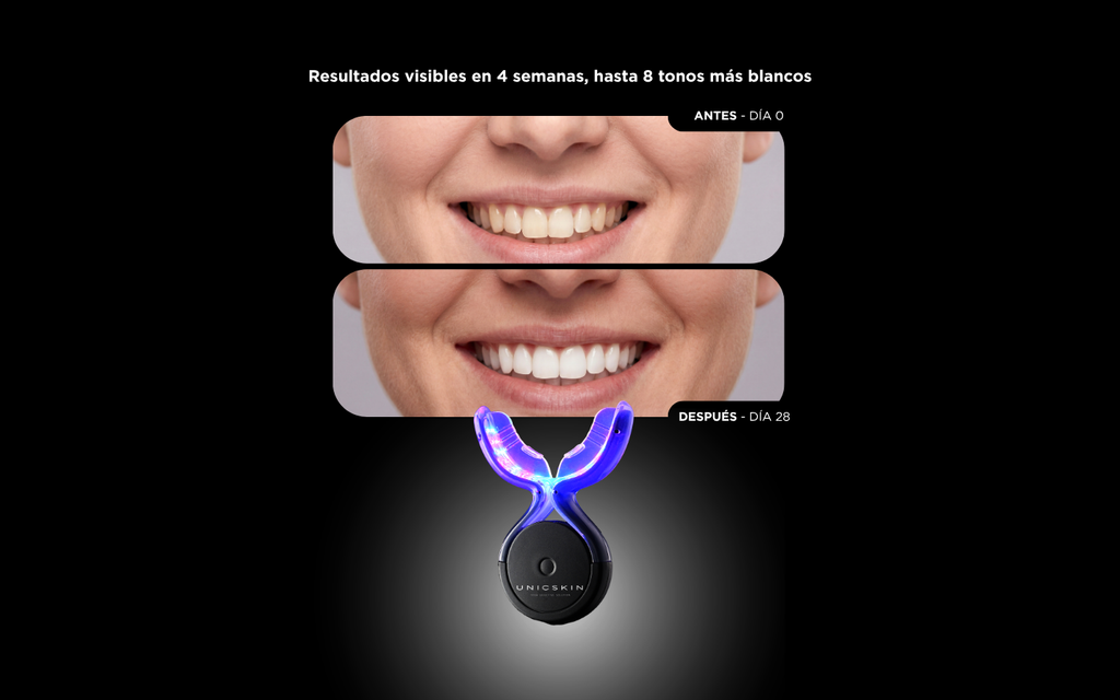 UNICLED WHITE SMILE 5.0