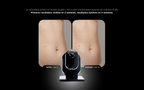 UNICTECH BODY SLIM x4