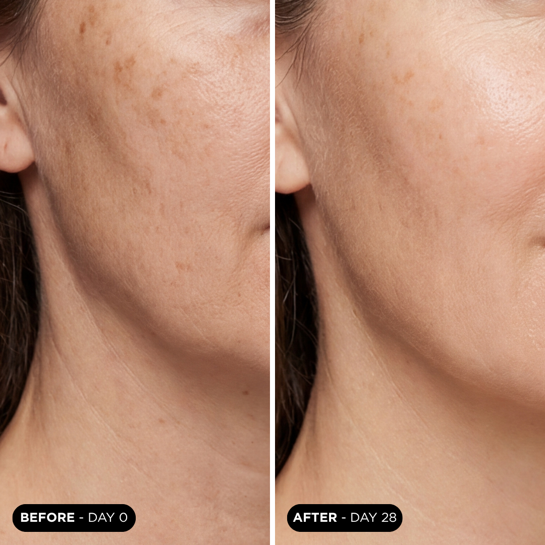 Resultados antes y después de usar UNICLUMINOSITY 3.0, serum vitamina c antes y despues