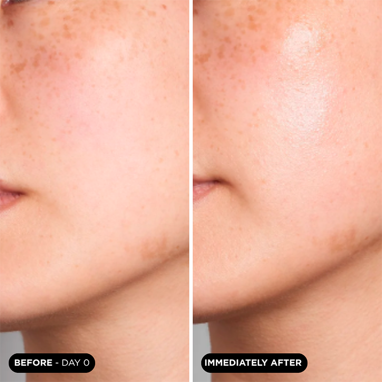 Antes y después mascarilla facial hidratante y rejuvenecedora UNICSKIN